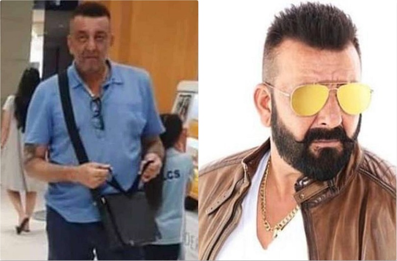 क्यान्सर पिडित संजय दत्तको बाहिरियो यस्तो तस्बिर